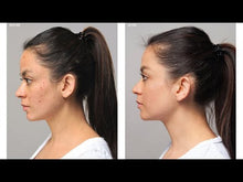 Load and play video in Gallery viewer, Acne Advanced Cleansing Foam