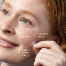 Load image into Gallery viewer, InvisiClear™ Hydrocolloid Spot Patches
